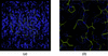 [Figure 11]