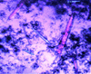 [Figure 1]