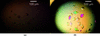[Figure 1]