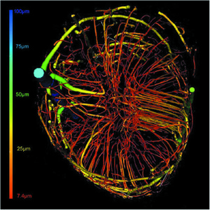 IUCr Synchrotron Radiation Micro Tomography For High Resolution