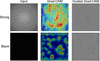 [Figure 11]