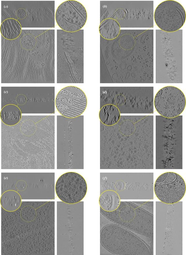 [Figure 1]