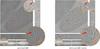 [Figure 11]
