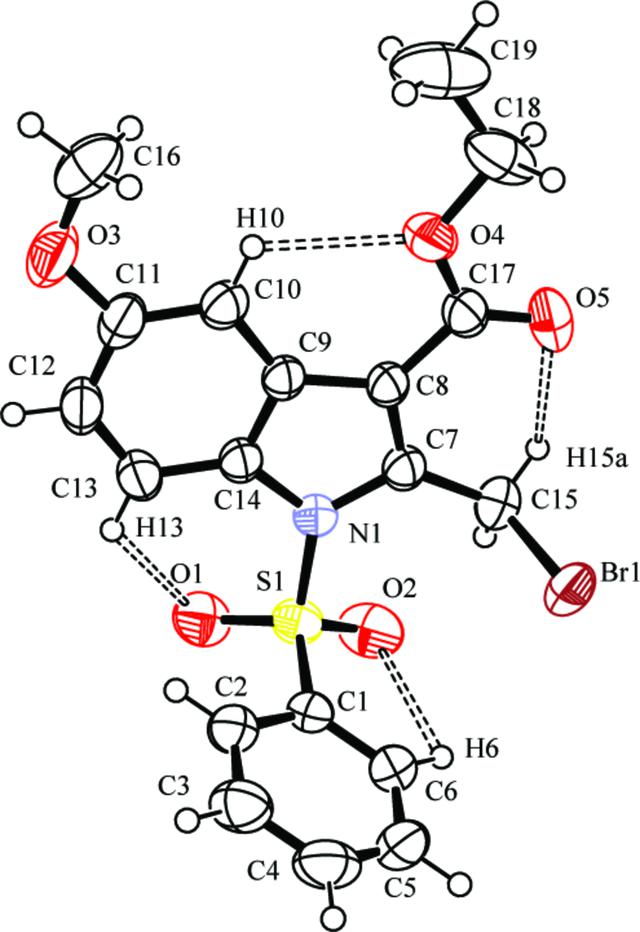 [Figure 1]