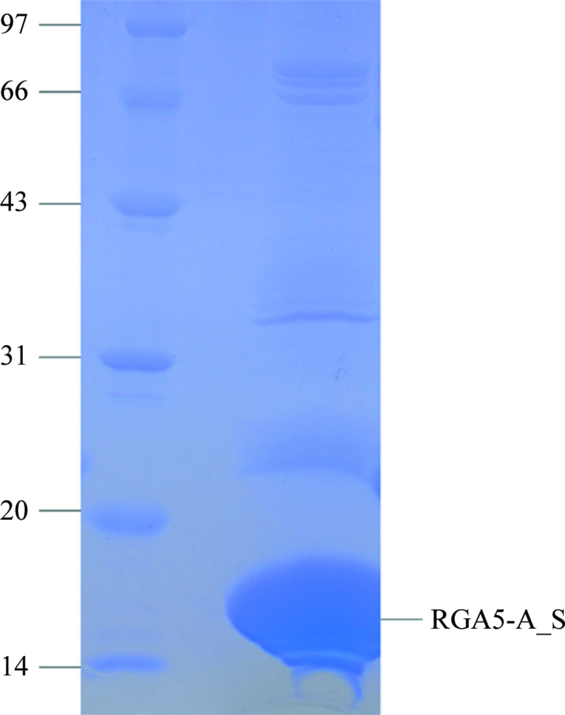 (IUCr) Expression, purification, crystallization and preliminary X-ray ...