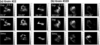 [Figure 11]