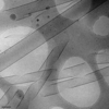 [Figure 4]