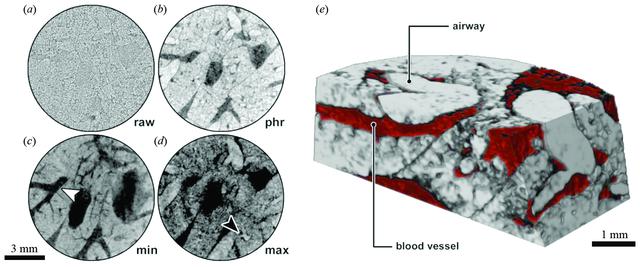 [Figure 1]