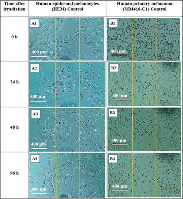 [Figure 12]