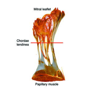 (IUCr) Structural properties in ruptured mitral chordae tendineae ...