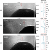 [Figure 11]