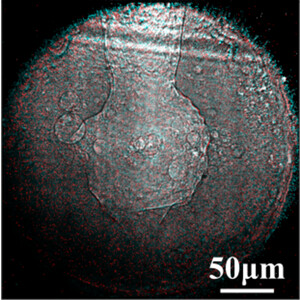 (IUCr) High-resolution in situ characterization of laser powder bed ...