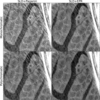 [Figure 6]