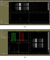 [Figure 11]
