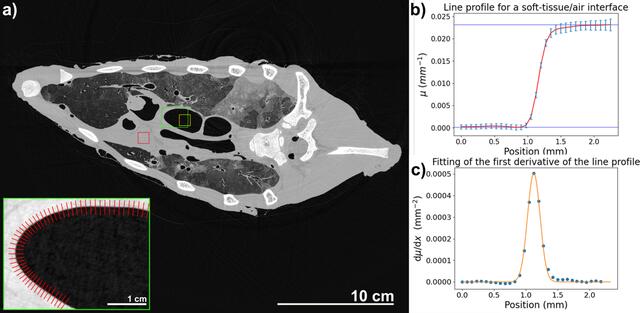 [Figure 1]