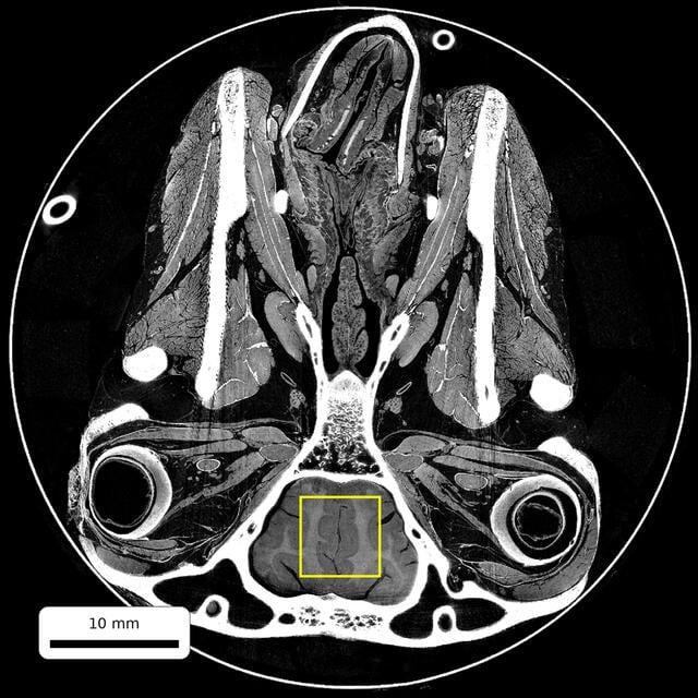 [Figure 2]
