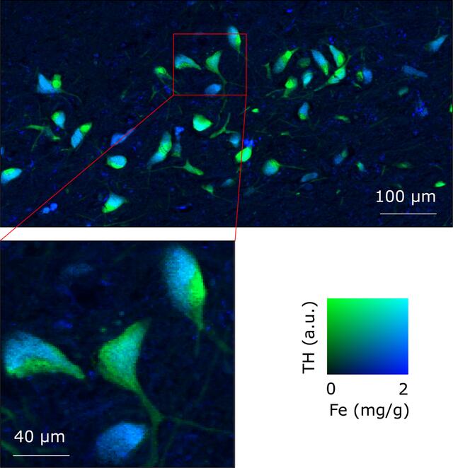 [Figure 11]